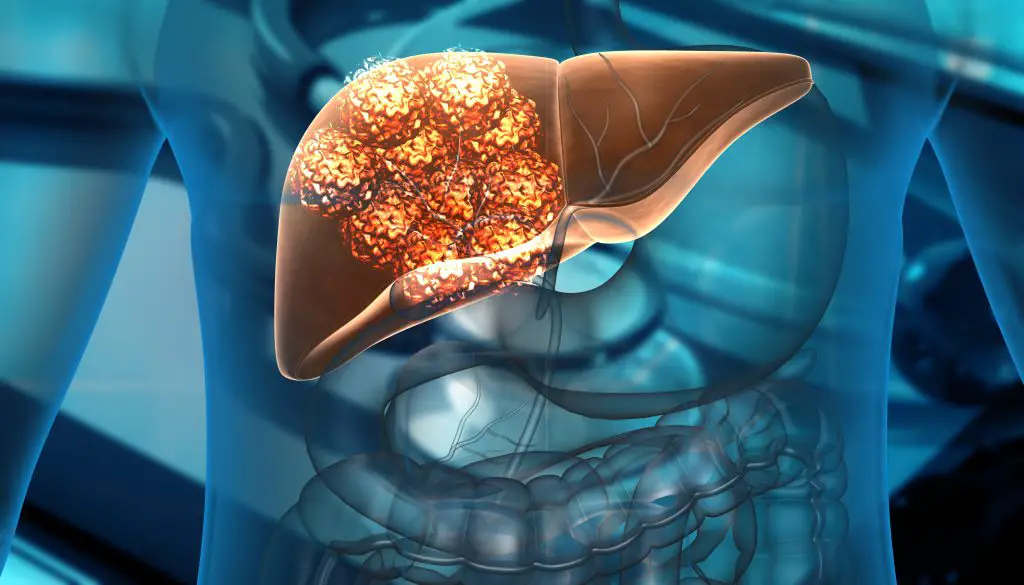 Survival rate of liver cancer
