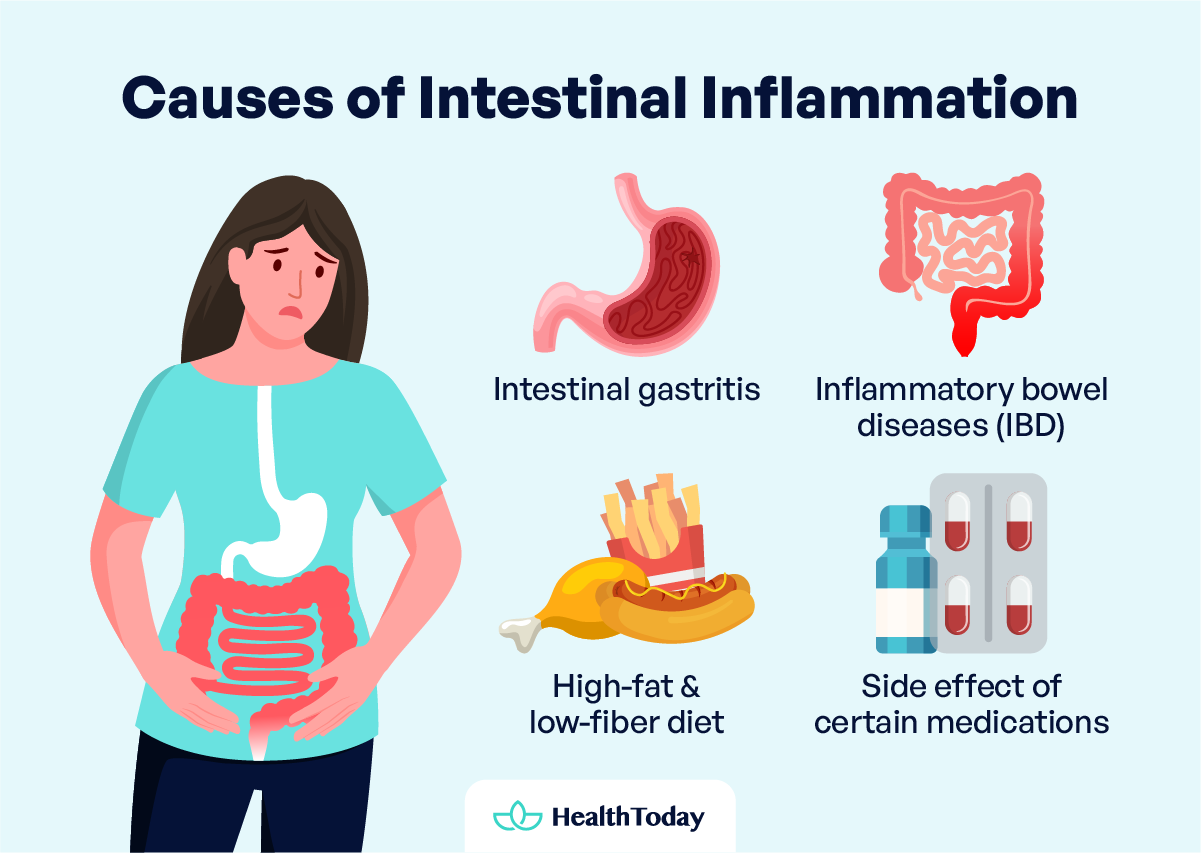 How To Calm Inflamed Intestines Causes and Treatment 02