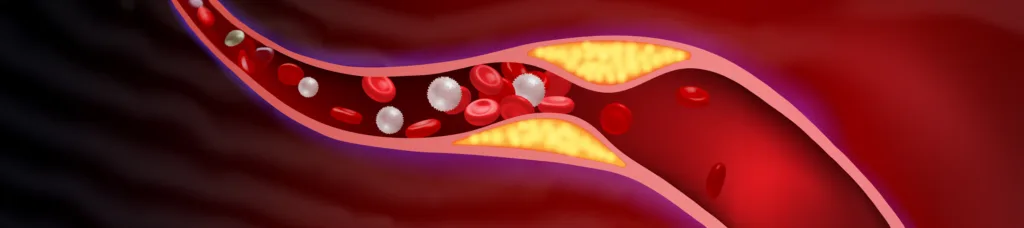 How Green Tea Helps You Clear Clogged Arteries